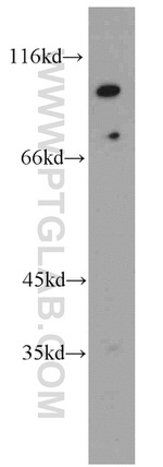 EWS Antibody in Western Blot (WB)