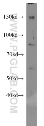 EWS Antibody in Western Blot (WB)