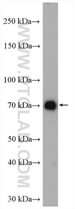 EWS Antibody in Western Blot (WB)