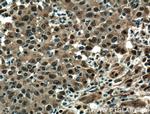 EWS Antibody in Immunohistochemistry (Paraffin) (IHC (P))