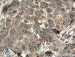 CSNK1A1 Antibody in Immunohistochemistry (Paraffin) (IHC (P))