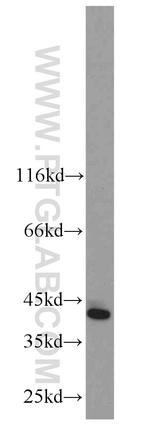 CSNK1A1 Antibody in Western Blot (WB)