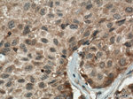 CSNK1A1 Antibody in Immunohistochemistry (Paraffin) (IHC (P))