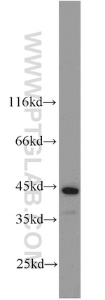 CSNK1A1 Antibody in Western Blot (WB)