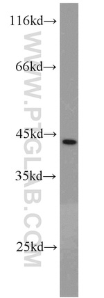 CSNK1A1 Antibody in Western Blot (WB)