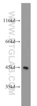 MBD2 Antibody in Western Blot (WB)