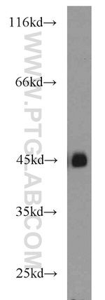 MBD2 Antibody in Western Blot (WB)