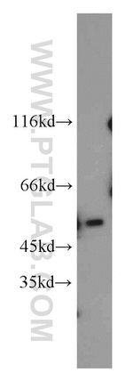 MBD2 Antibody in Western Blot (WB)