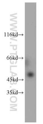 MBD2 Antibody in Western Blot (WB)