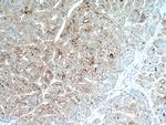 SET Antibody in Immunohistochemistry (Paraffin) (IHC (P))