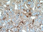 SET Antibody in Immunohistochemistry (Paraffin) (IHC (P))