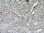 IGFBP5 Antibody in Immunohistochemistry (Paraffin) (IHC (P))