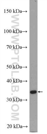 IGFBP5 Antibody in Western Blot (WB)