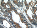 PCSK9 Antibody in Immunohistochemistry (Paraffin) (IHC (P))