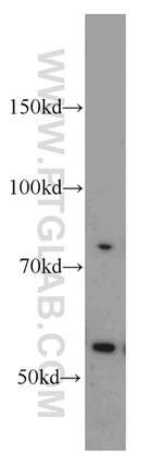 PCSK9 Antibody in Western Blot (WB)