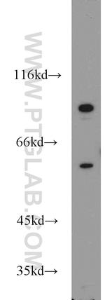 PCSK9 Antibody in Western Blot (WB)