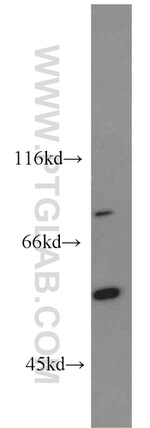 PCSK9 Antibody in Western Blot (WB)