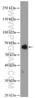 PCSK9 Antibody in Western Blot (WB)