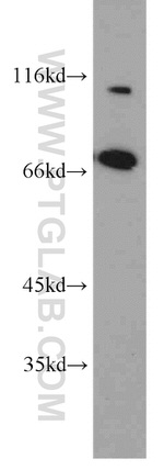 PLS1 Antibody in Western Blot (WB)