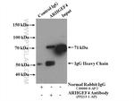 ARHGEF4 Antibody in Immunoprecipitation (IP)