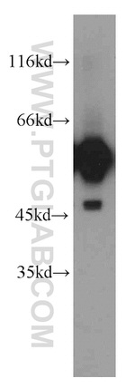 GDI1 Antibody in Western Blot (WB)