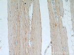 PLS3 Antibody in Immunohistochemistry (Paraffin) (IHC (P))