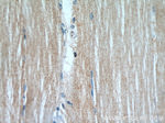 PLS3 Antibody in Immunohistochemistry (Paraffin) (IHC (P))