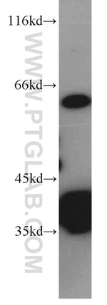 PLS3 Antibody in Western Blot (WB)