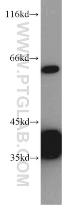 PLS3 Antibody in Western Blot (WB)