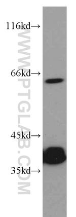 PLS3 Antibody in Western Blot (WB)