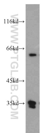 PLS3 Antibody in Western Blot (WB)