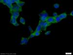 CaMKII beta Antibody in Immunocytochemistry (ICC/IF)