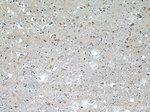 CaMKII beta Antibody in Immunohistochemistry (Paraffin) (IHC (P))