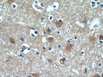 CaMKII beta Antibody in Immunohistochemistry (Paraffin) (IHC (P))