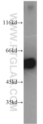 CaMKII beta Antibody in Western Blot (WB)