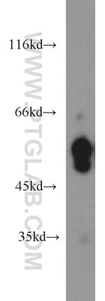 CaMKII beta Antibody in Western Blot (WB)