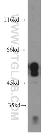 CaMKII beta Antibody in Western Blot (WB)