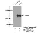 HCN1 Antibody in Immunoprecipitation (IP)