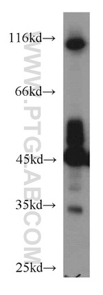 NSE/ENO2 Antibody in Western Blot (WB)
