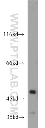 NSE/ENO2 Antibody in Western Blot (WB)