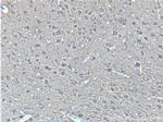 NSE/ENO2 Antibody in Immunohistochemistry (Paraffin) (IHC (P))