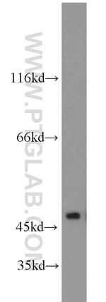 NSE/ENO2 Antibody in Western Blot (WB)