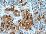 ENO1 Antibody in Immunohistochemistry (Paraffin) (IHC (P))