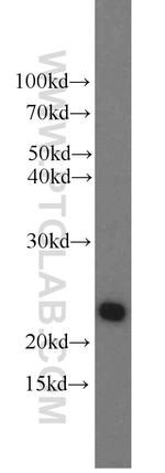 Growth hormone Antibody in Western Blot (WB)