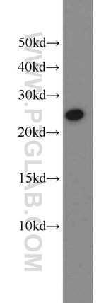 Growth hormone Antibody in Western Blot (WB)