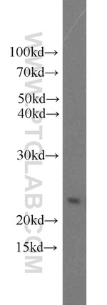 Growth hormone Antibody in Western Blot (WB)