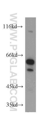 CARM1 Antibody in Western Blot (WB)