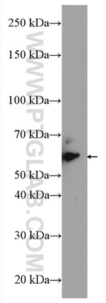 CARM1 Antibody in Western Blot (WB)