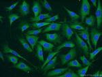 CARM1 Antibody in Immunocytochemistry (ICC/IF)