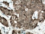 CARM1 Antibody in Immunohistochemistry (Paraffin) (IHC (P))